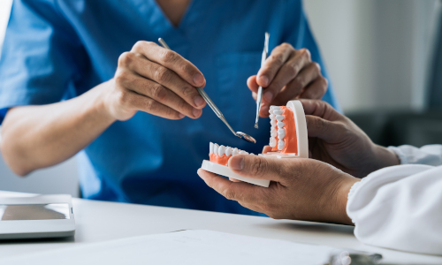 Higienizacja, Renowacja protez