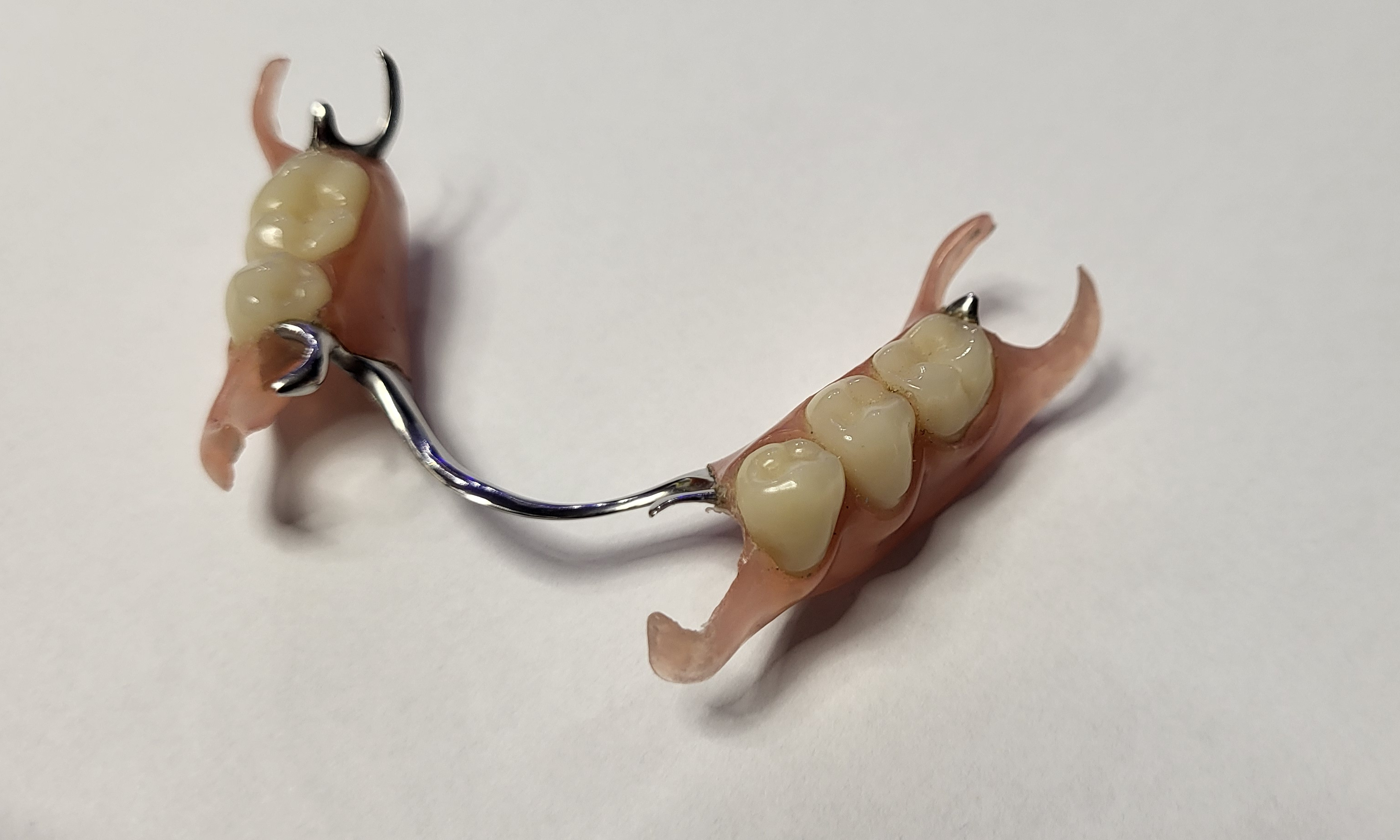 Proteza szkieletowa połączona z materiałami termoplastycznymi np. acron lub nylon