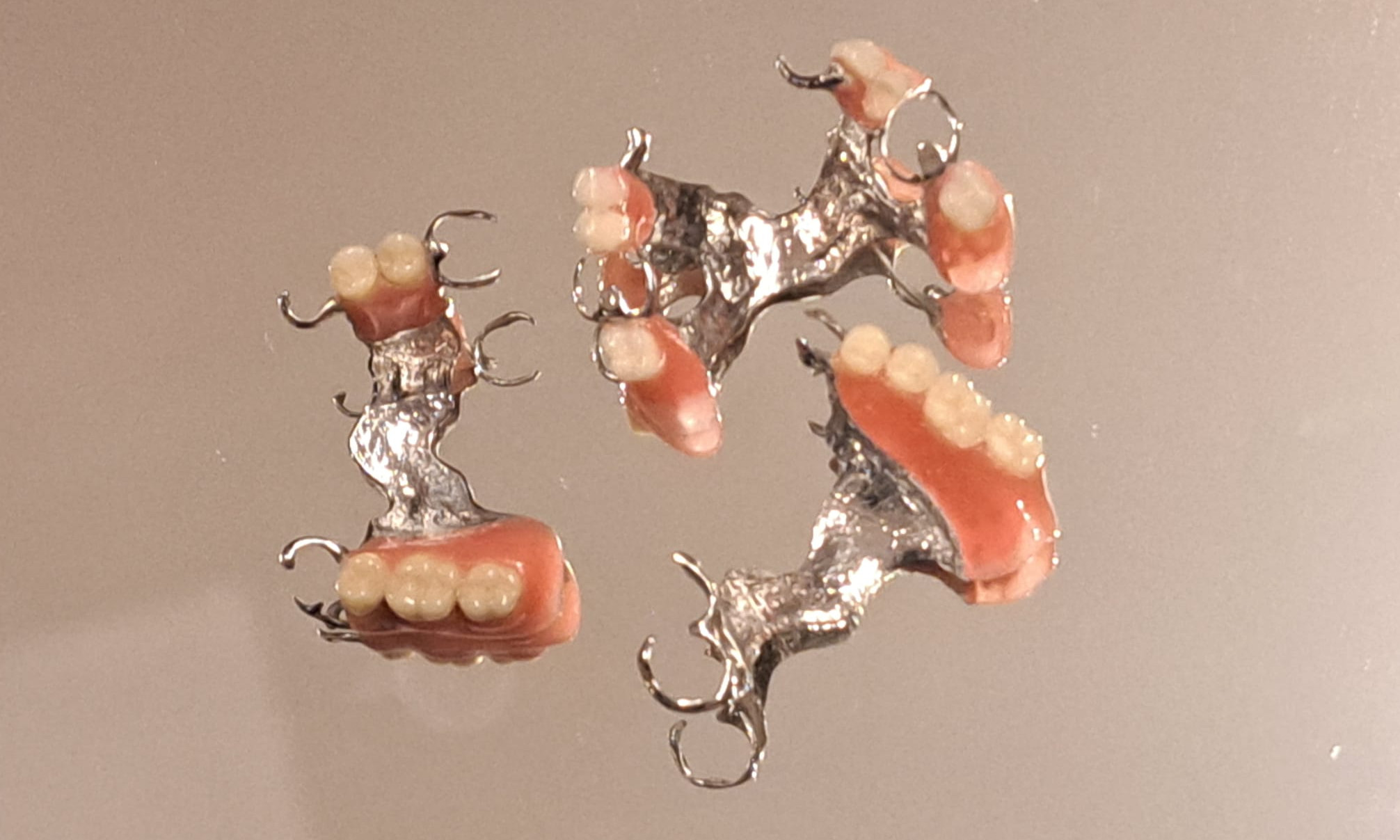 proteza szkieletowa na zatrzaskach, bezklamrowa, na implantach